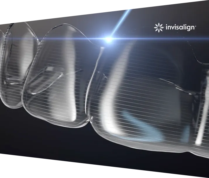Invisalign Treatment in London | Bow Lane Dental
