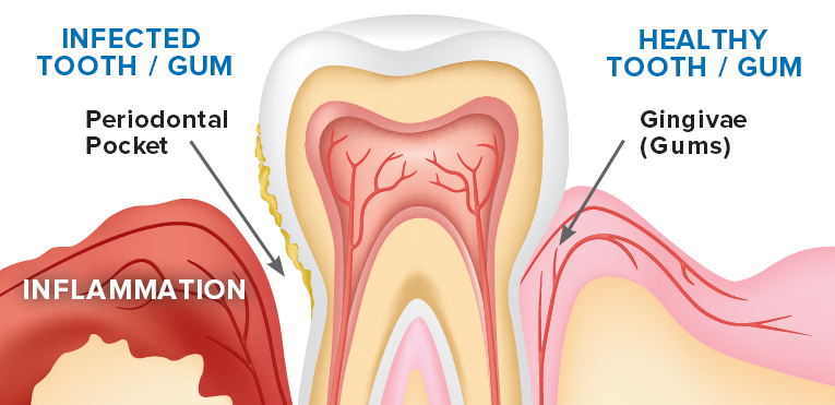 Gum treatments London