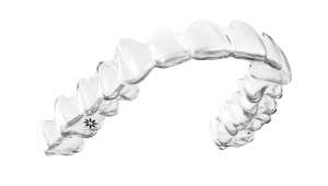 Invisalign aligners Bow Lane Dental Group London