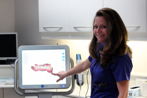 CEREC Crowns