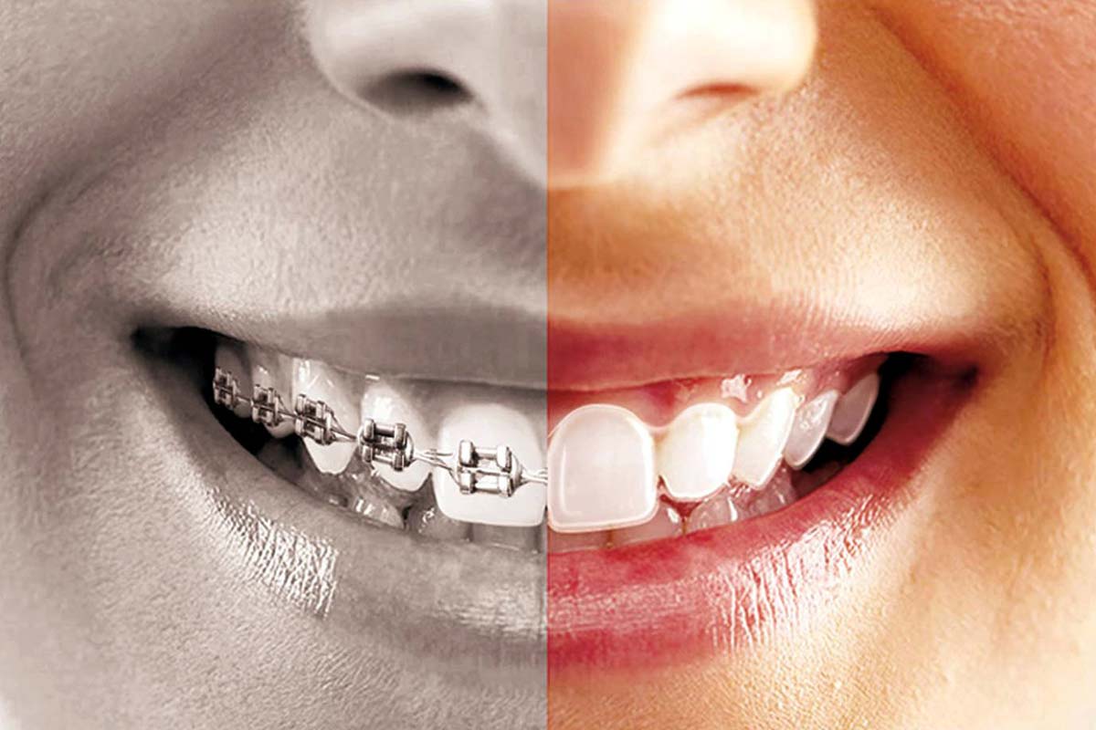 Can Orthodontics change your life?