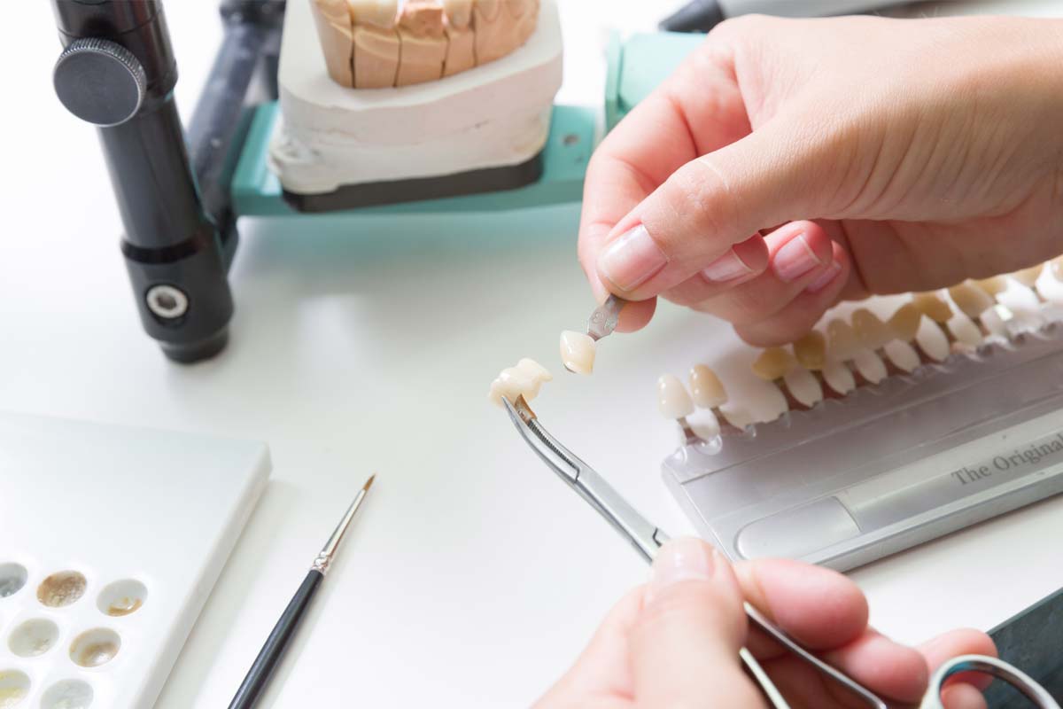 Dental veneers: Something to smile about