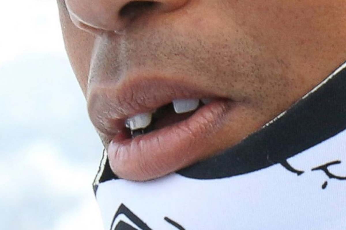 Bad teeth can harm your career!
