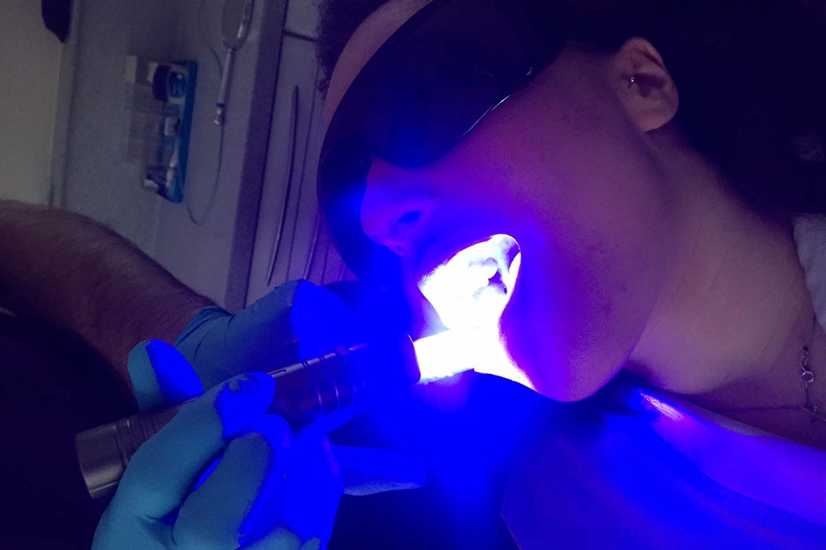 Screening for mouth cancer