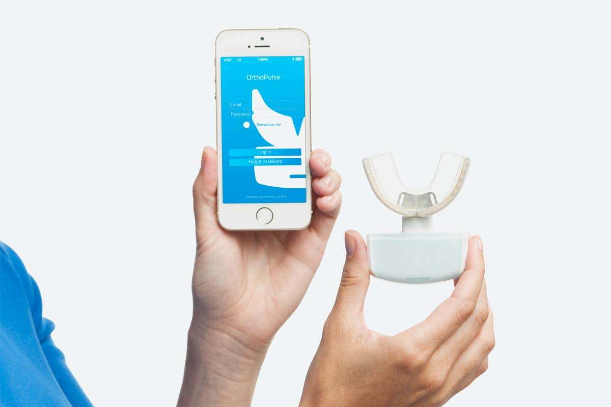 Straighten your teeth faster with Orthopulse