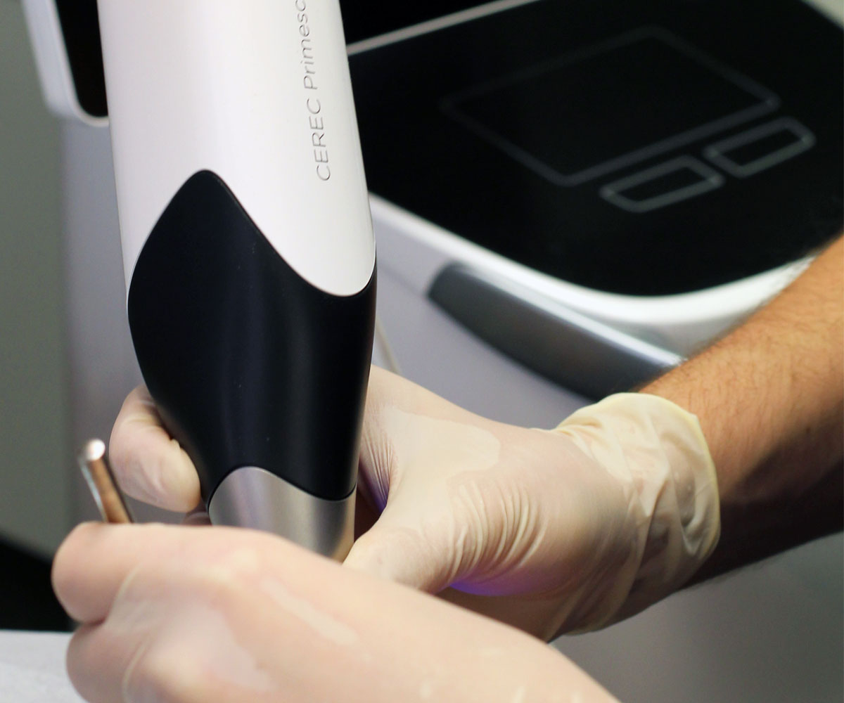 Crown in a day with CEREC