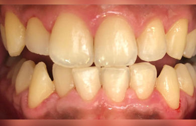 Hygiene Example