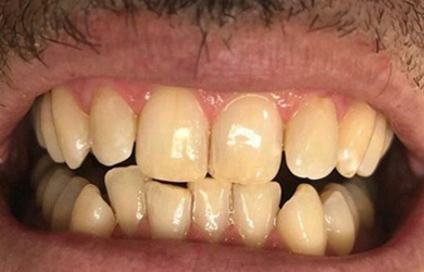 Hygiene Example