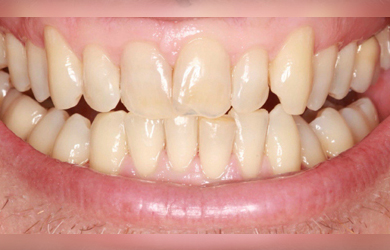 Hygiene Example